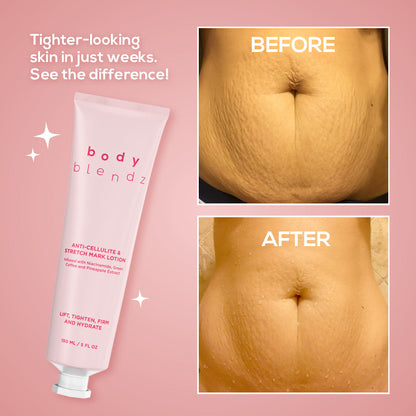 Anti-Cellulite & Stretch Mark Lotion
